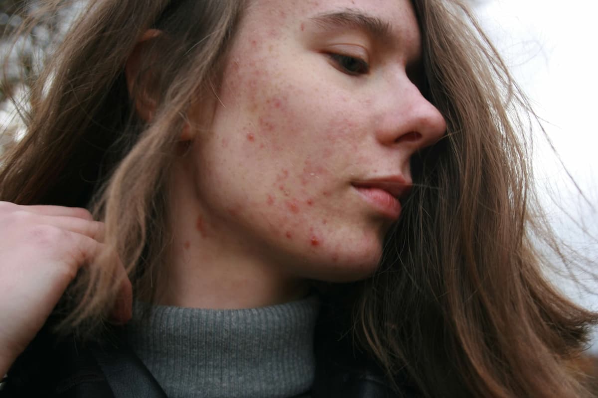 Woman with clear glowing skin in natural light